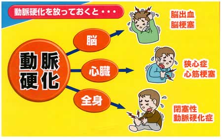 動脈硬化に関係する主な疾患